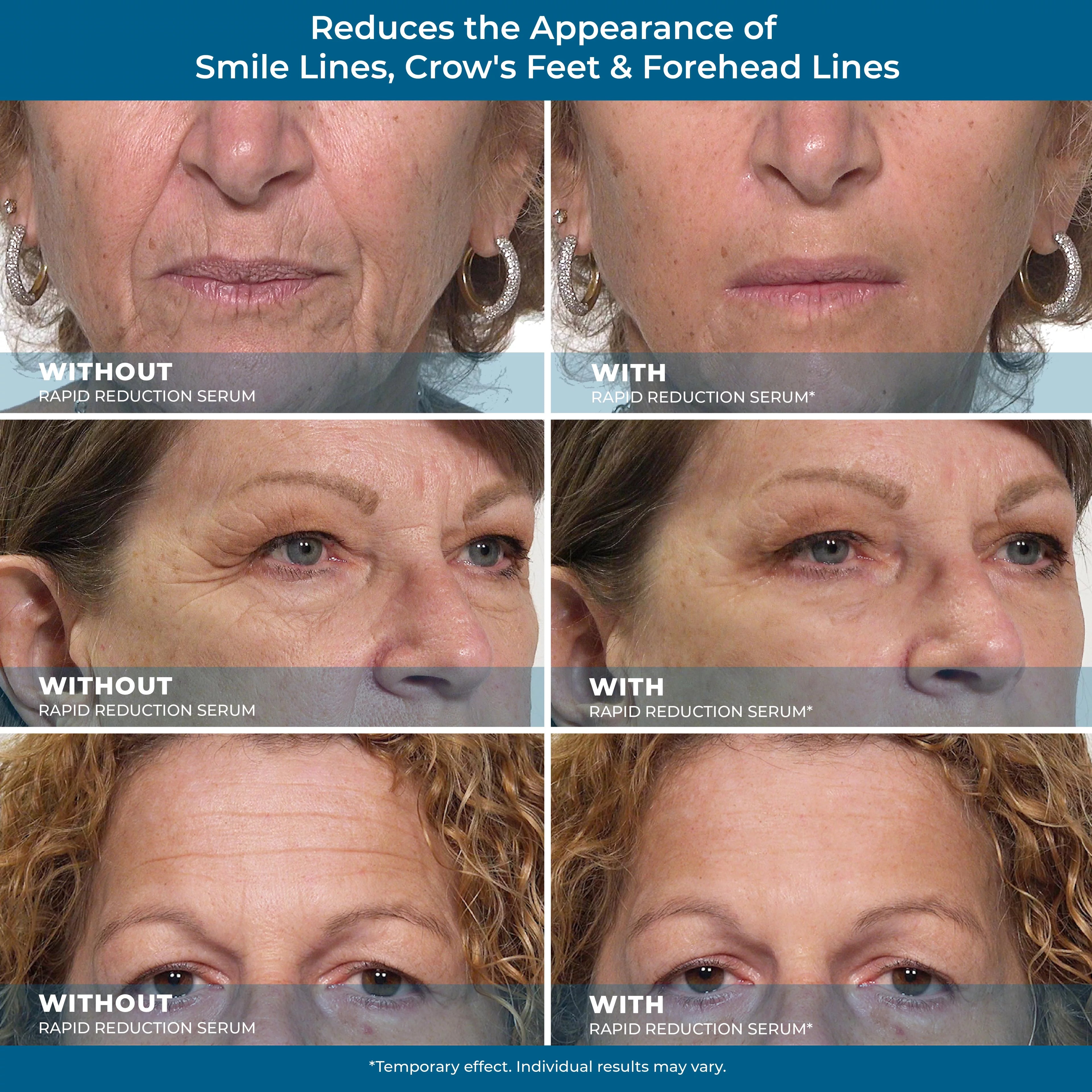 Rapid Reduction Eye Serum B721