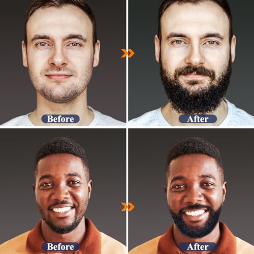 Beard Growth Kit with Beard Growth Oil (2 Packs), Beard Balm, Beard Comb R80433